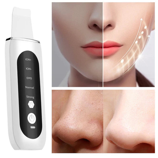 UltrasonicPEN®️ | Piel rejuvenecida, exfoliada e hidratada ✨