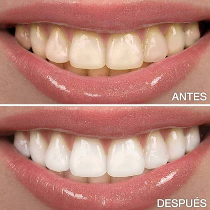 Gel V34® - Blanqueamiento Rápido